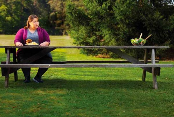 Obesity Study - SURMOUNT 3