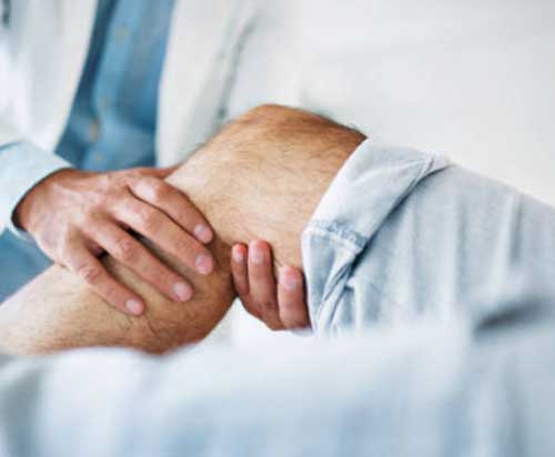 Knee osteoarthritis (OA)