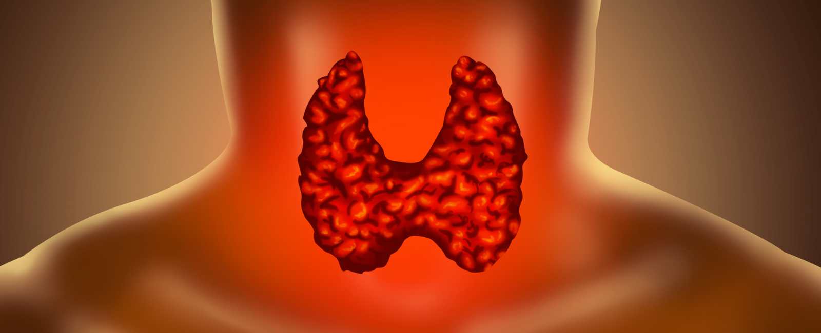 Do You Take Thyroid Medication Precision Clinical Research