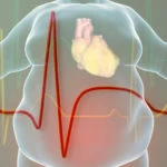 Obesity SURMOUNT-3 Study