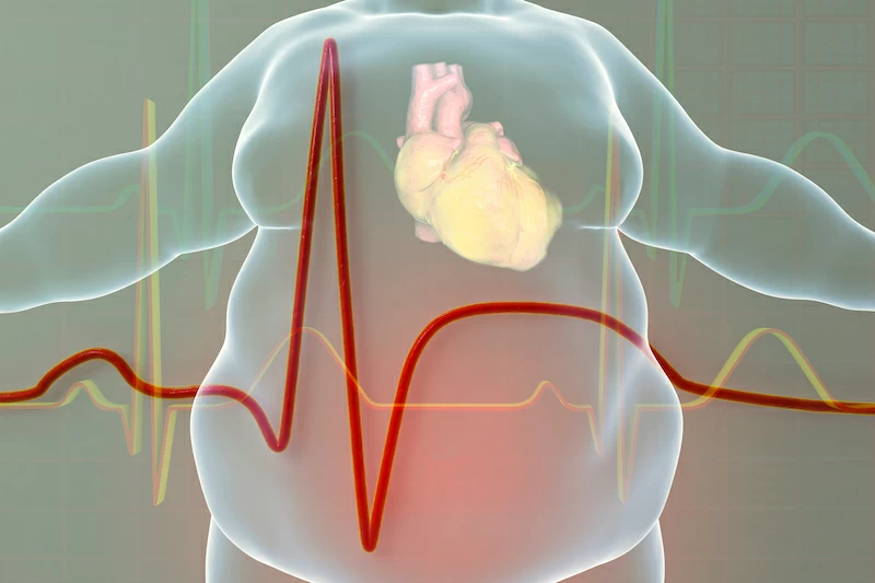 Obesity SURMOUNT-3 Study